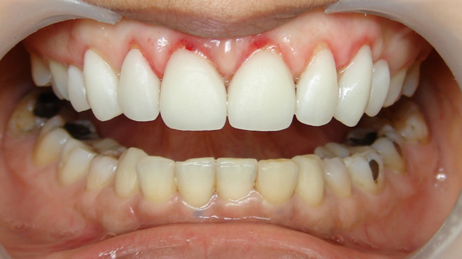 Cosmetic Dentistry in India