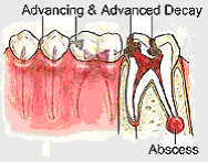 Dental Treatment in India